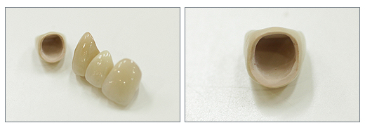 �I�[���Z���~�b�N